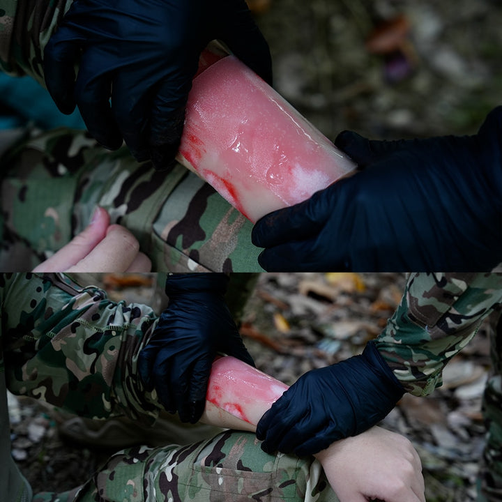 Burn Care Kit